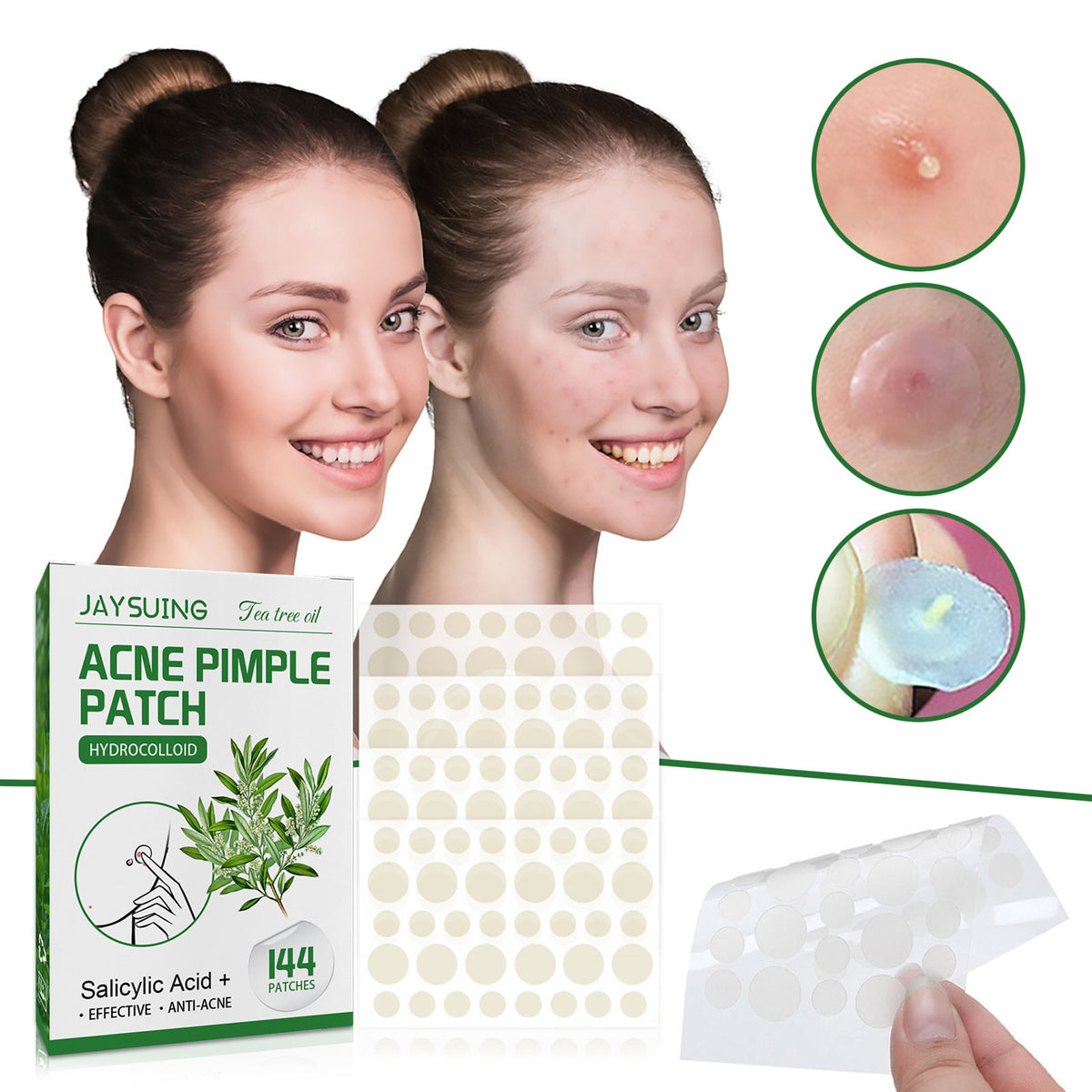 - Get Medical-Grade Acne Care with 144Pcs Acne Pimple Patches